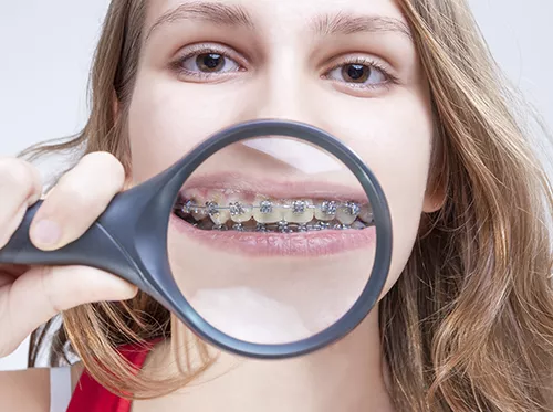 tips-for-braces-care_6588