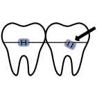 Loose Appliance icon