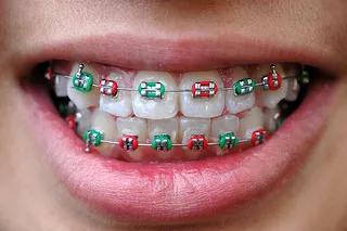 ortho-kids-running.jpg