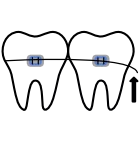 Loose Wire icon